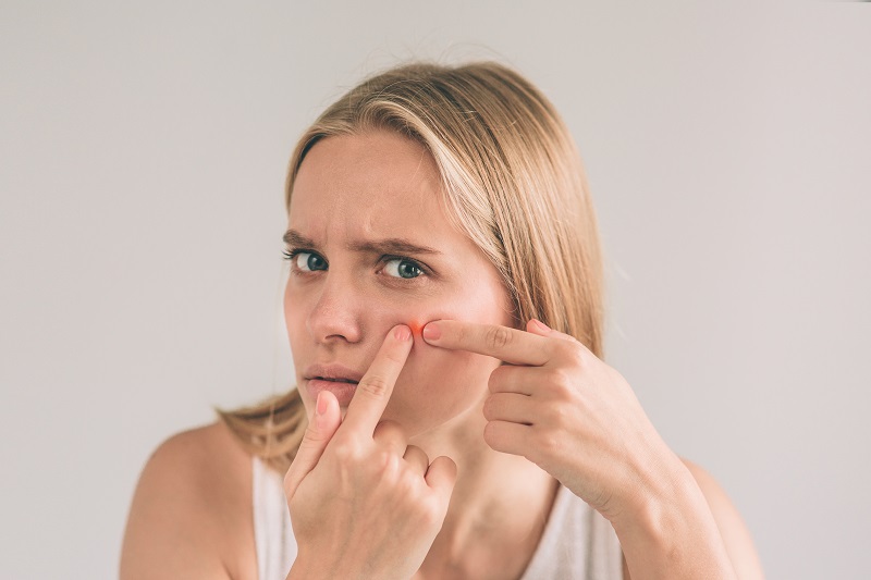 Pelle grassa e seborroica: 3 prodotti che non possono mancare nella tua beauty routine